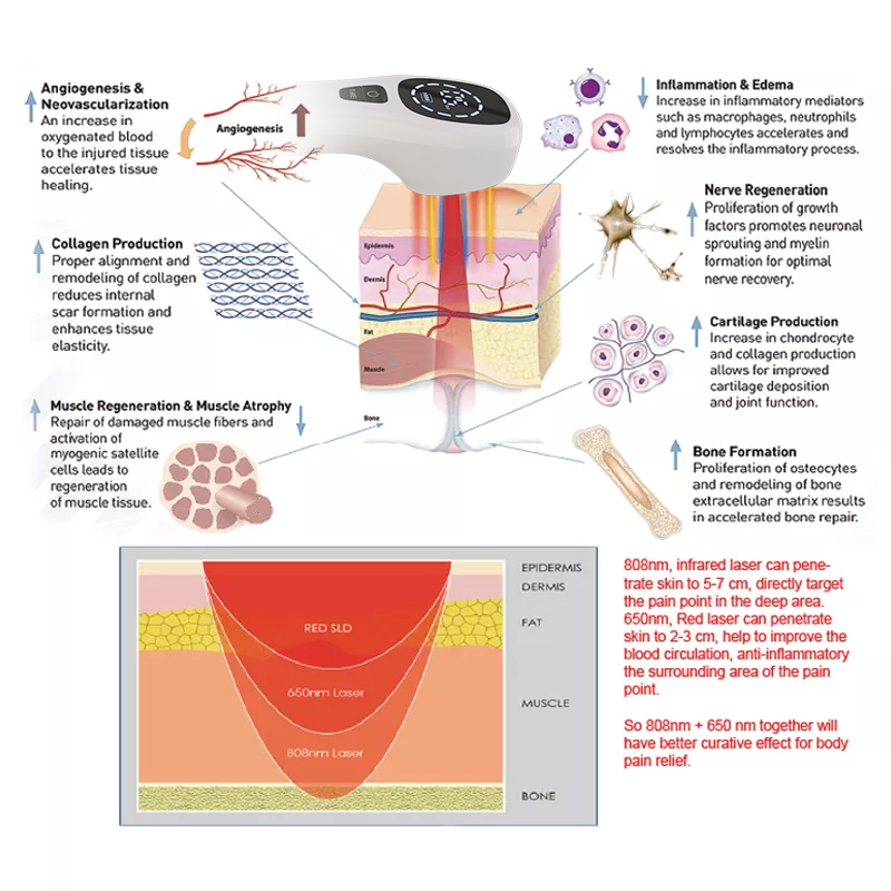 2x808nm Cold Laser Therapy Dev - Badminton Bag 评论和价格